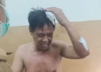 Anggota DPRD Takalar Johan Nojeng saat dirawat di RSUD Takalar setelah dihantam double stick oleh Ketua PDIP Takalar, Andi Noor Zaelan atau lebih populer Andi Ellang. (Foto: era.id)